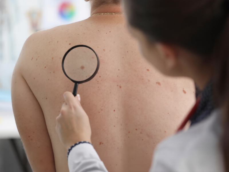 Skin Disease Treatment